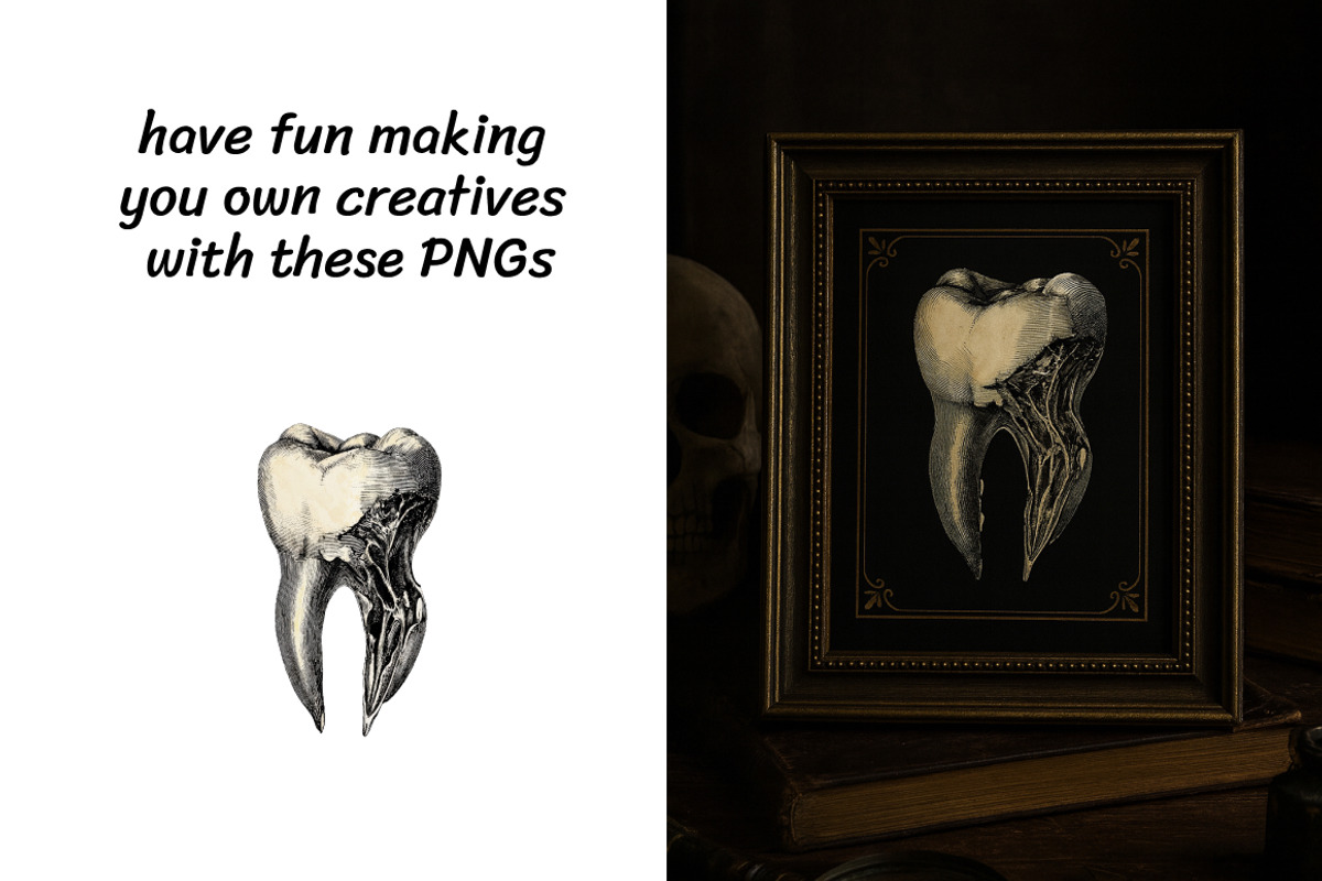Dark Vintage Tooth Clipart Bundle, a Healthcare Illustration by InkyQueenArt (Photo 3 of 5)
