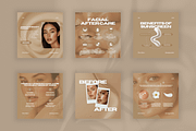 Aesthetic Skincare Insta Templates, a Social Media Template by Xenié Creative (Thumbnail 4 of 10)