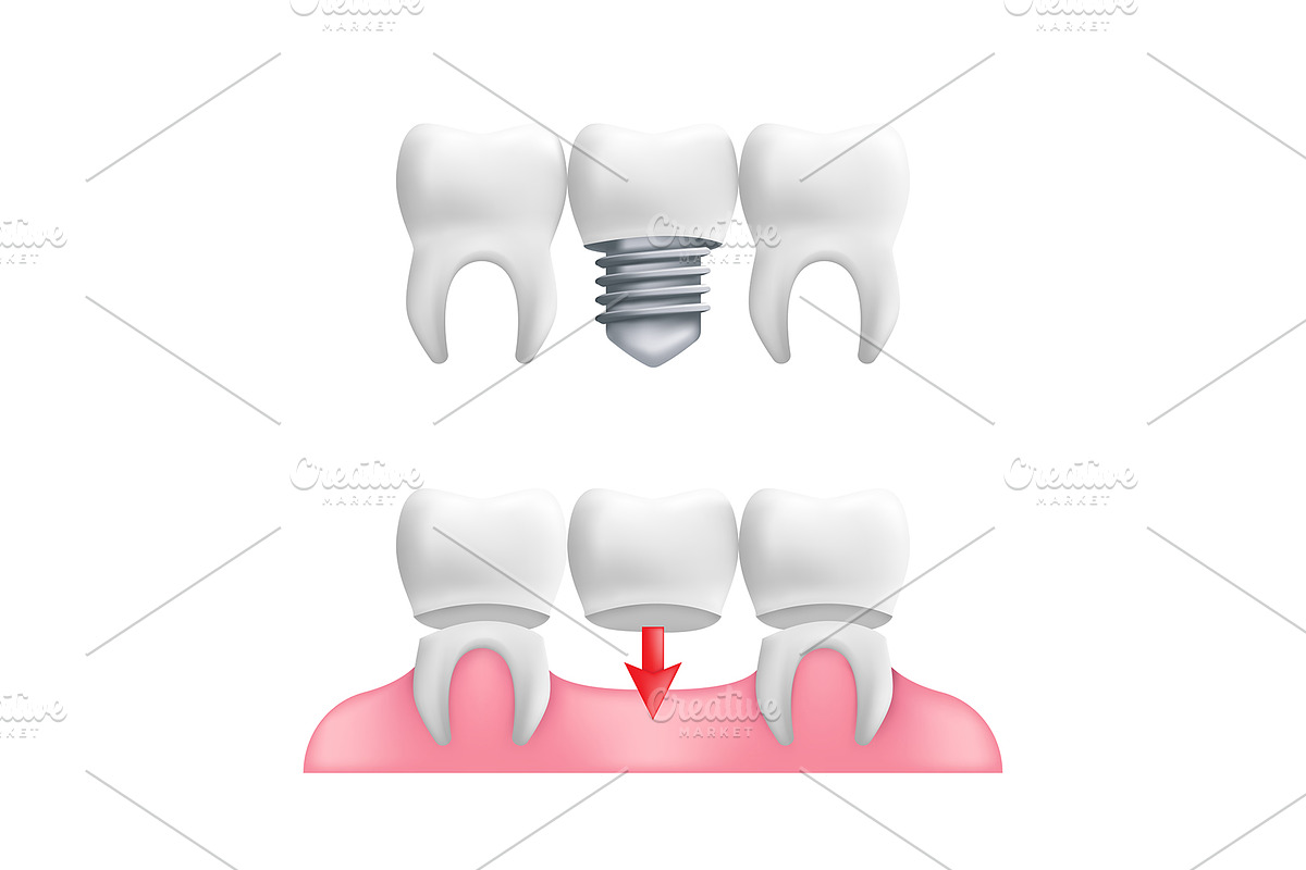 Dental Care Vector Icons set, an Emoji Icon by Rodionoff (Photo 2 of 6)