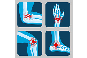 Human joints with pain rings, a Background Graphic by Valerie Bodnar