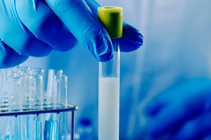 laboratory worker holding a test tube with semen, a Photo by Nito
