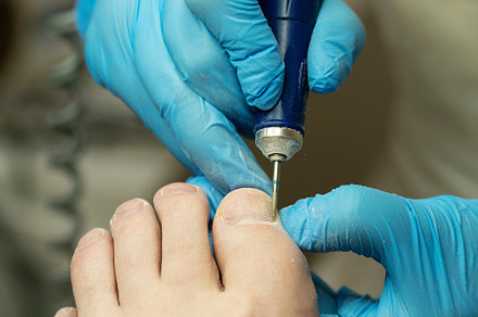 Gloved technician works on toenails