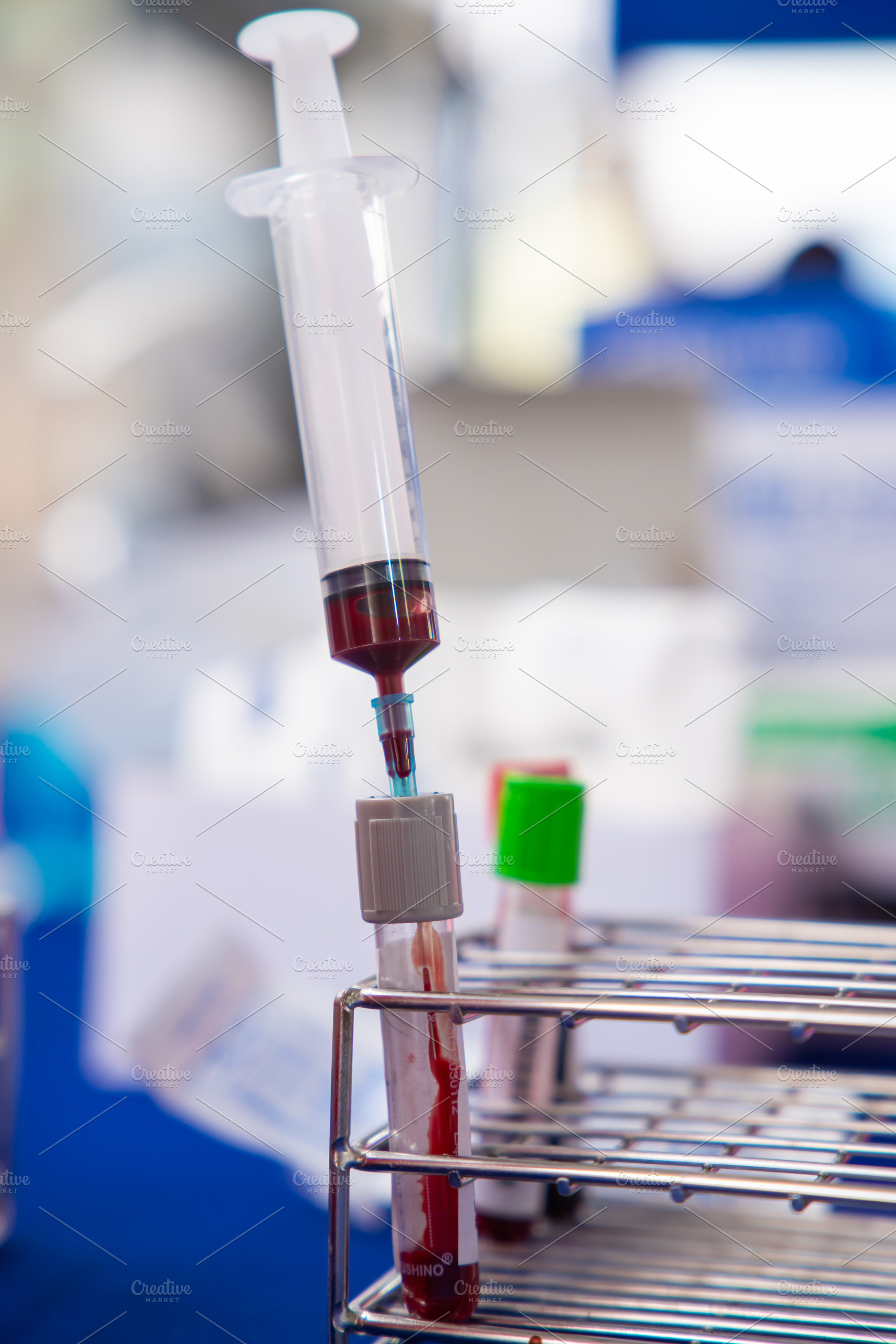 Close up blood sample for diagnosis and treatment patient in the, a Photo by Casanowe-studio