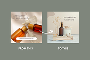 Instagram Templates for Skincare, a Social Media Template by Parrot Designs (Thumbnail 4 of 5)