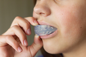 Orthodontic mouth guard for teeth, a Health & Medical Photo by Nastya_Velko