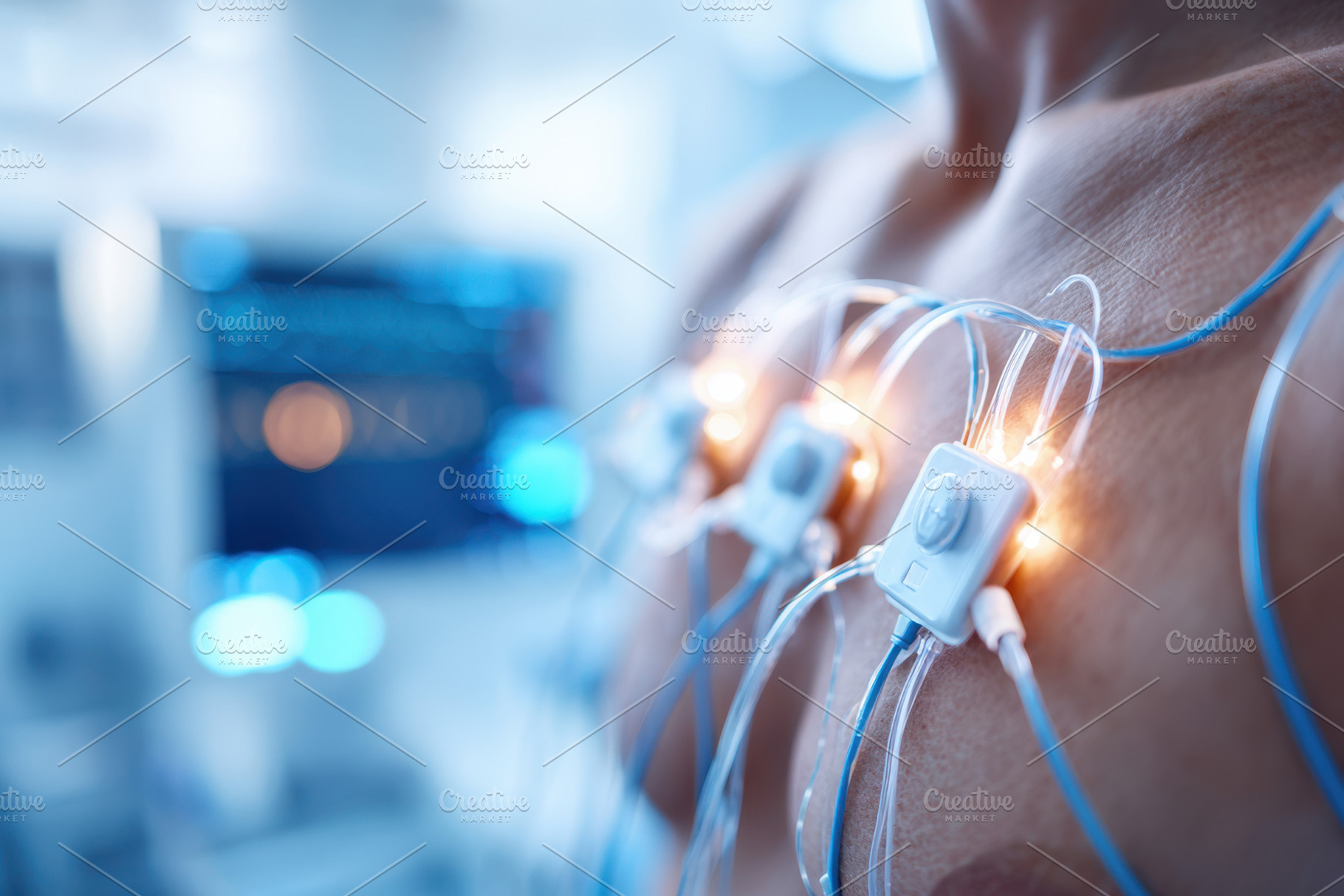 Close-up of medical electrodes on a patient's chest, a Health & Medical Photo by AlyaAnd
