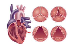Medical illustration shows the, an Object Illustration by Things for designers