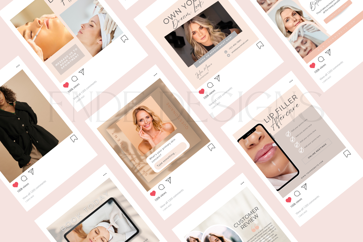Beauty Botox and Filler Instagram, a Social Media Template by FNDE_DESIGNS1368 (Photo 4 of 6)