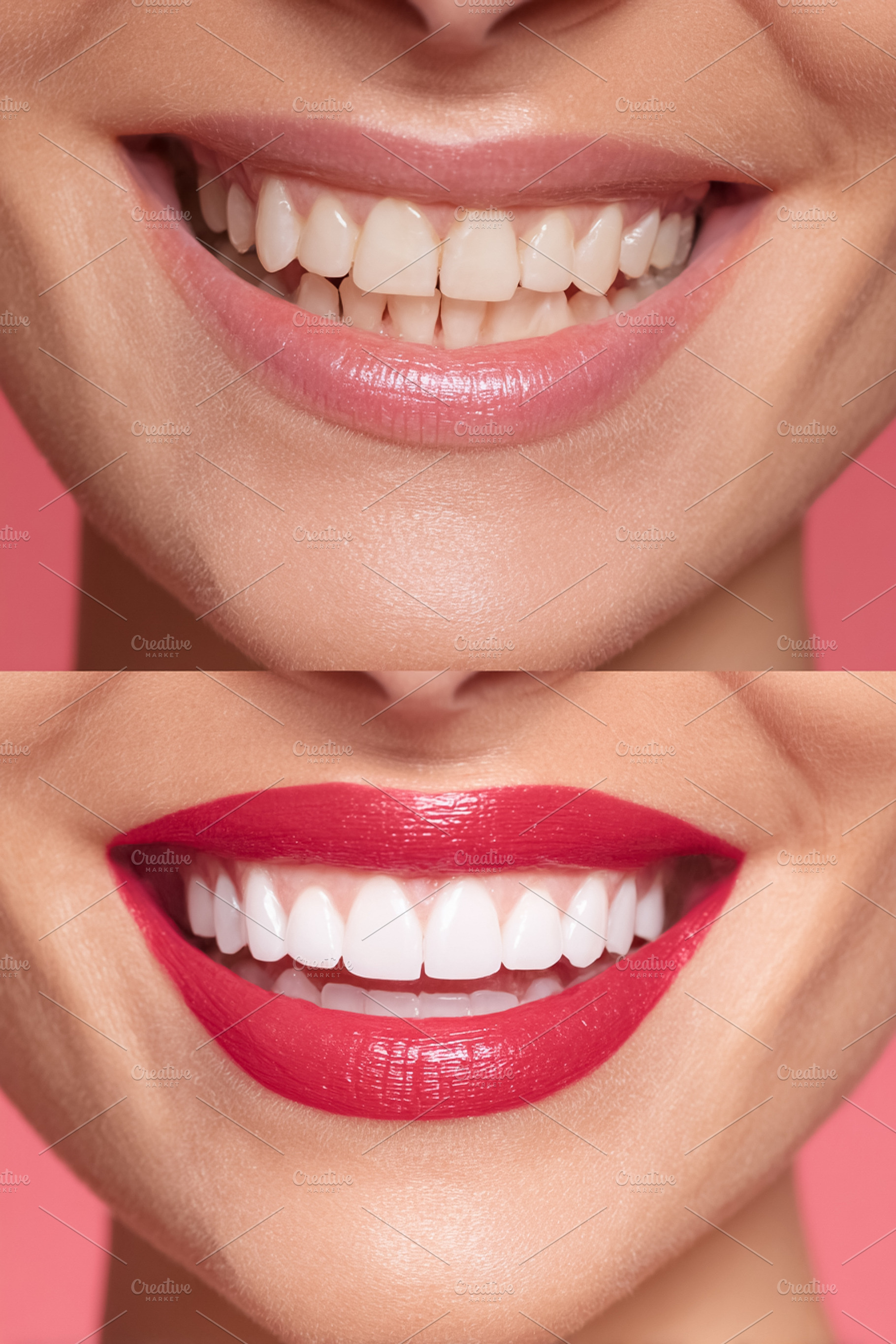 Woman showing teeth before and after whitening treatment, achieving a perfect,, a Photo by Studio ANNA