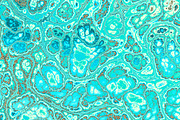 20 turquoise textures 64 Megapixel, a Texture Graphic by tkdesign (Thumbnail 17 of 20)