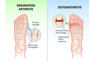 Foot disease poster. Medical, an Object Illustration by YummyBuum