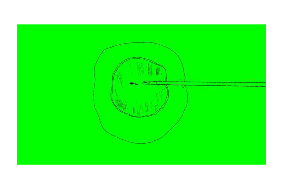 Animation In Vitro Fertilization, a Graphic by patrimonio | Creative Market