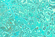 20 turquoise textures 64 Megapixel, a Texture Graphic by tkdesign (Thumbnail 14 of 20)