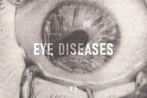 Eye Diseases 60 Scanned Images