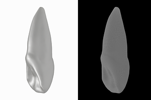 Human Upper Left Central Incisor