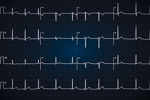 Electrocardiogram graph on dark blue, a Healthcare Illustration by BestPics