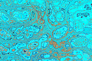 20 turquoise textures 64 Megapixel, a Texture Graphic by tkdesign (Thumbnail 20 of 20)