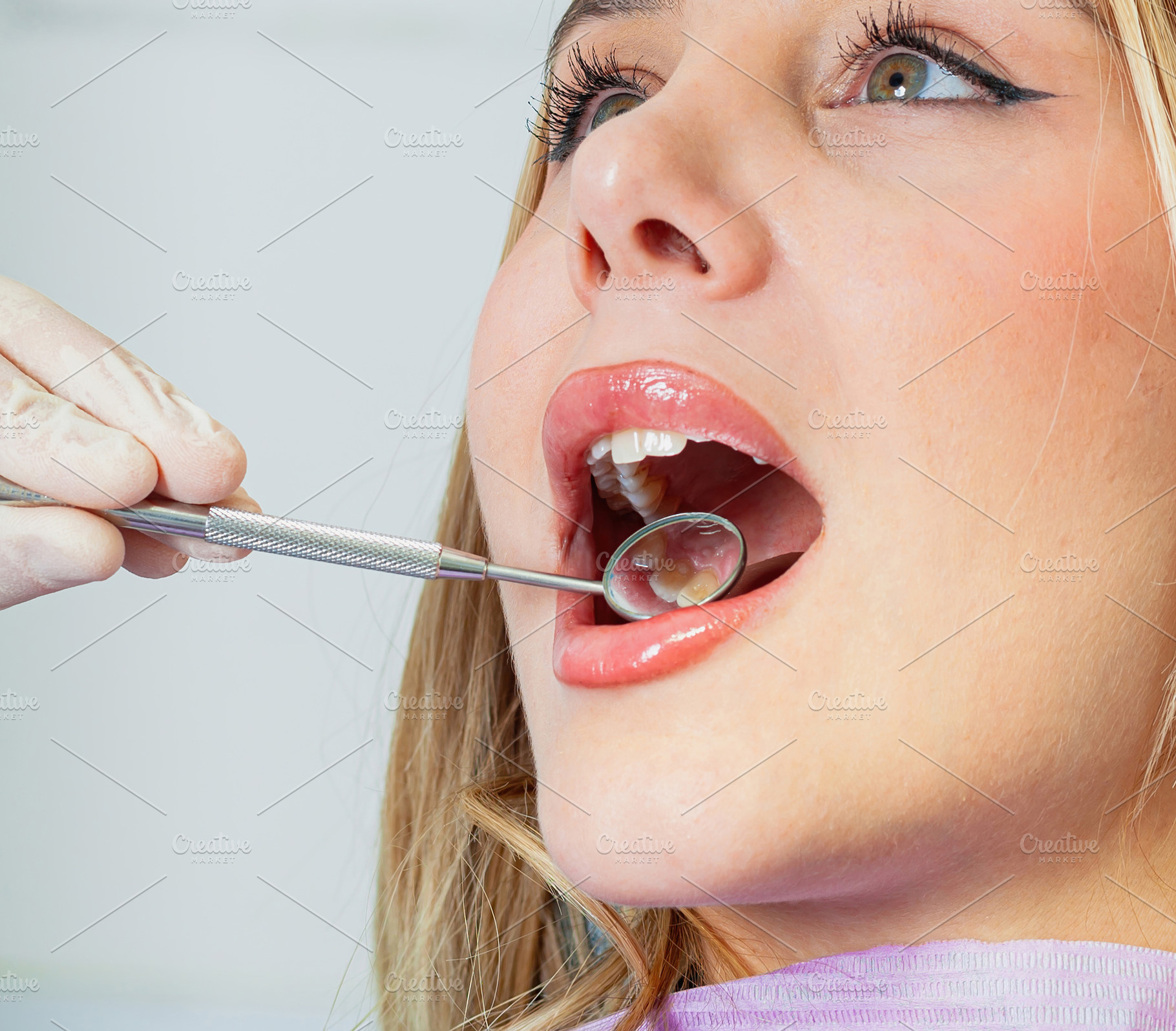Dentist examining patient's teeth with dental mirror and explorer, a Health & Medical Photo by Antonio Gravante Market