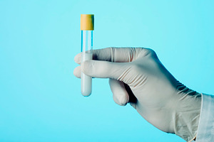 man with a test tube with semen, web banner, a Photo by Nito