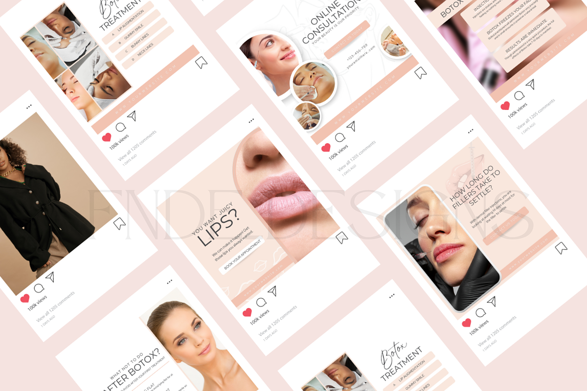 Beauty Botox and Filler Instagram, a Social Media Template by FNDE_DESIGNS1368 (Photo 6 of 6)