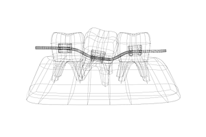 Dental Braces System 3d Model