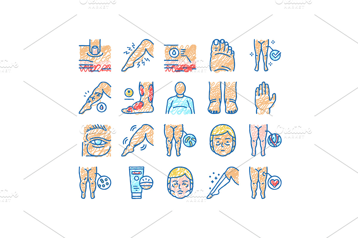 Edema Disease Symptom set Icons hand, an Object Illustration by pikepicture