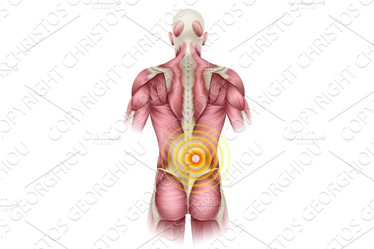 Lower Back Pain Medical Anatomy, a Healthcare Illustration by Christos Georghiou