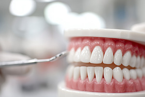 Close up of a dental model, a Health & Medical Photo by MistyDay