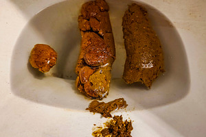 Human feces inside a toilet, a Health & Medical Photo by DanFLCreativo