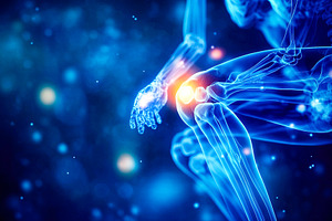 Knee Joint Pain Concept, a Health & Medical Photo by Ales Munt