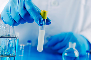 man holding a test tube with semen in a laboratory, a Photo by Nito