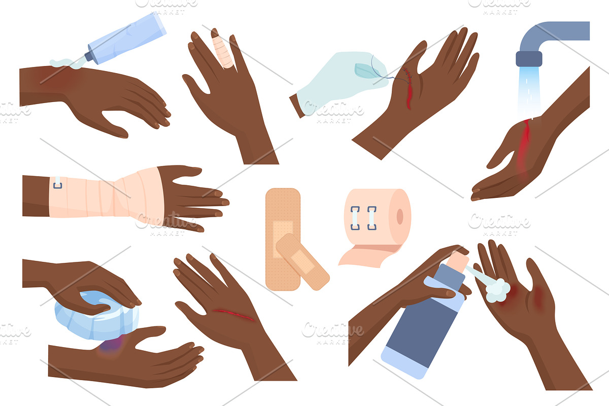 First aid for hand injury vector set, an Object Illustration by Lemberg Vector