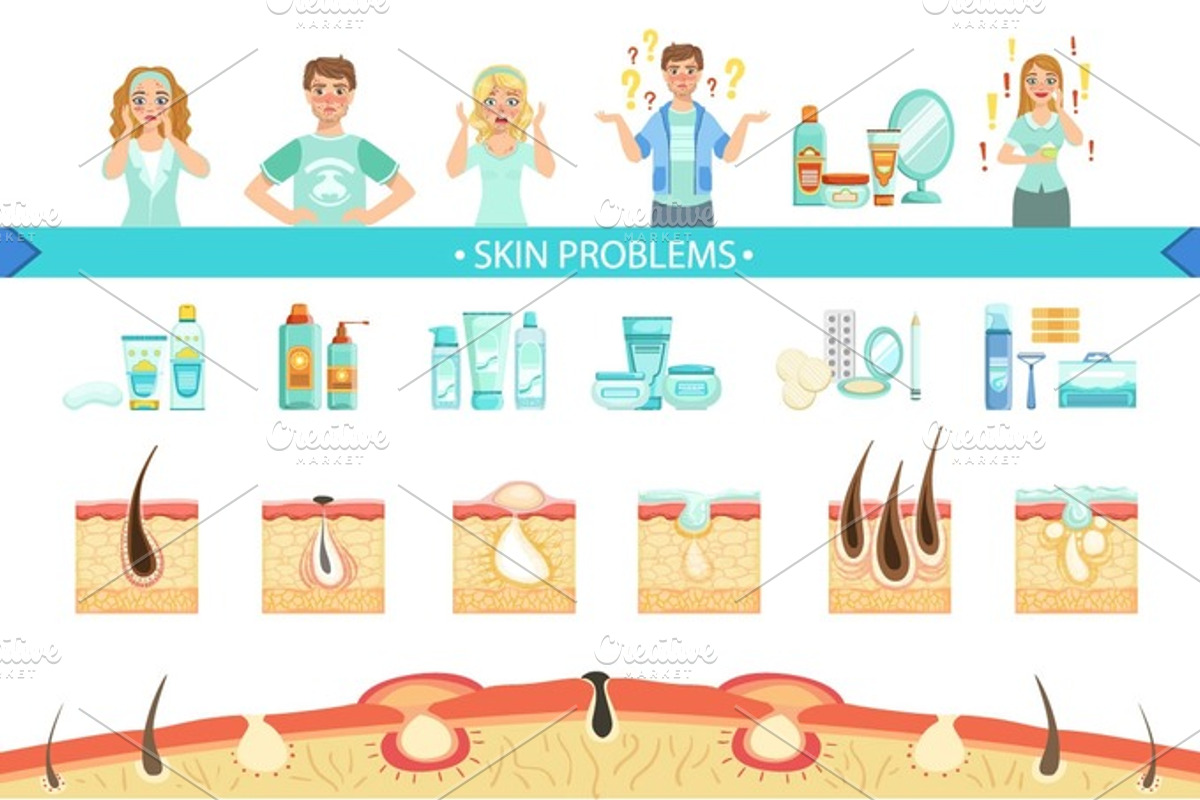 Skin Problems Infographic Medical Poster, a Healthcare Illustration by ...