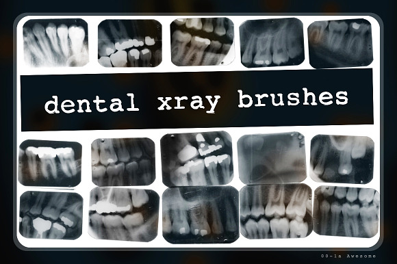 Dental X-ray Brushes preview 7