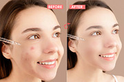 Smooth Skin Pro Photoshop Action, an Action Add-On by MRI STUDIO (Thumbnail 3 of 8)