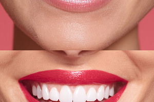 Woman showing teeth before and after whitening treatment, achieving a perfect,, a Photo by Studio ANNA