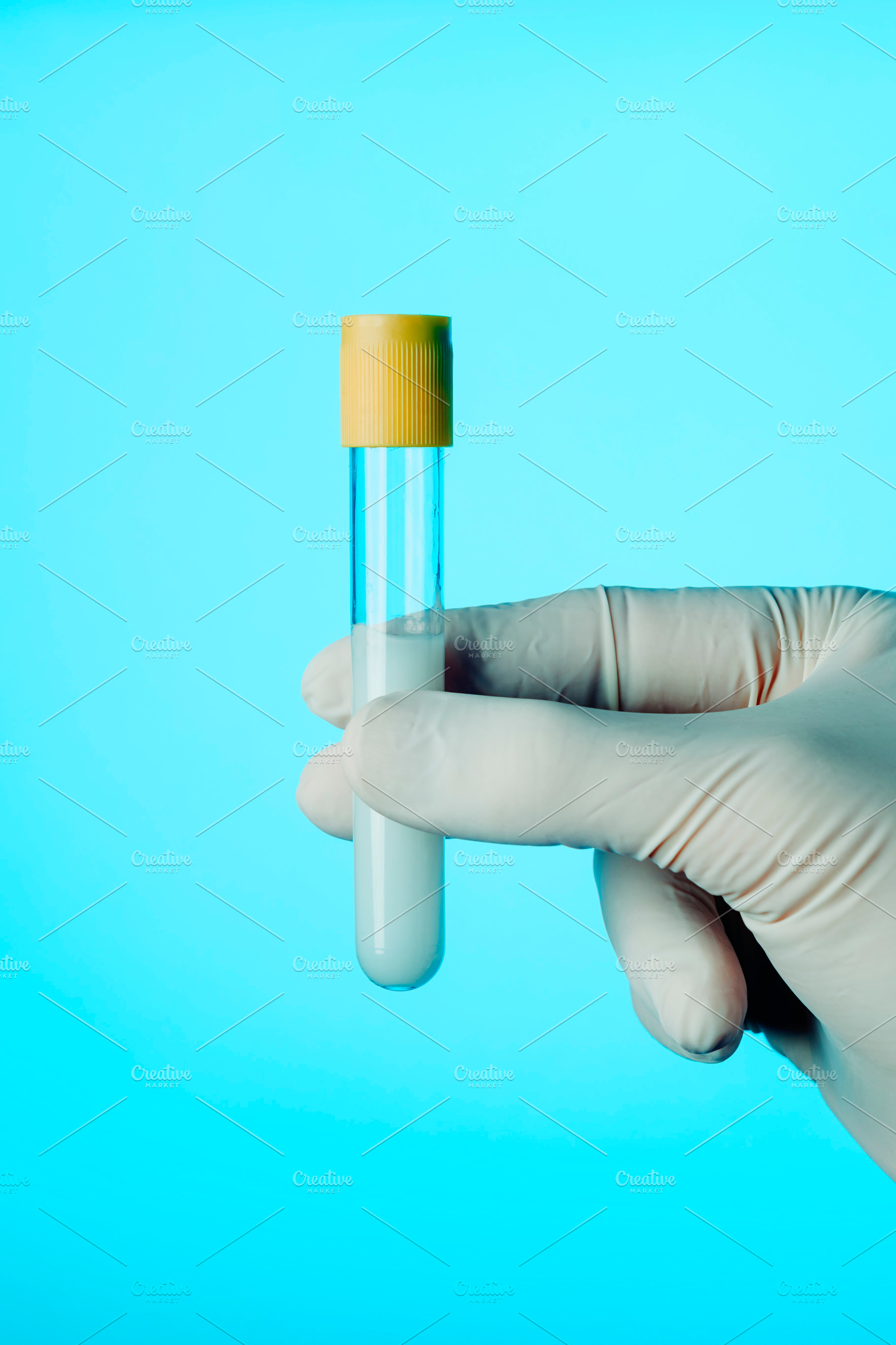 healthcare worker with a test tube with some semen, a Photo by Nito