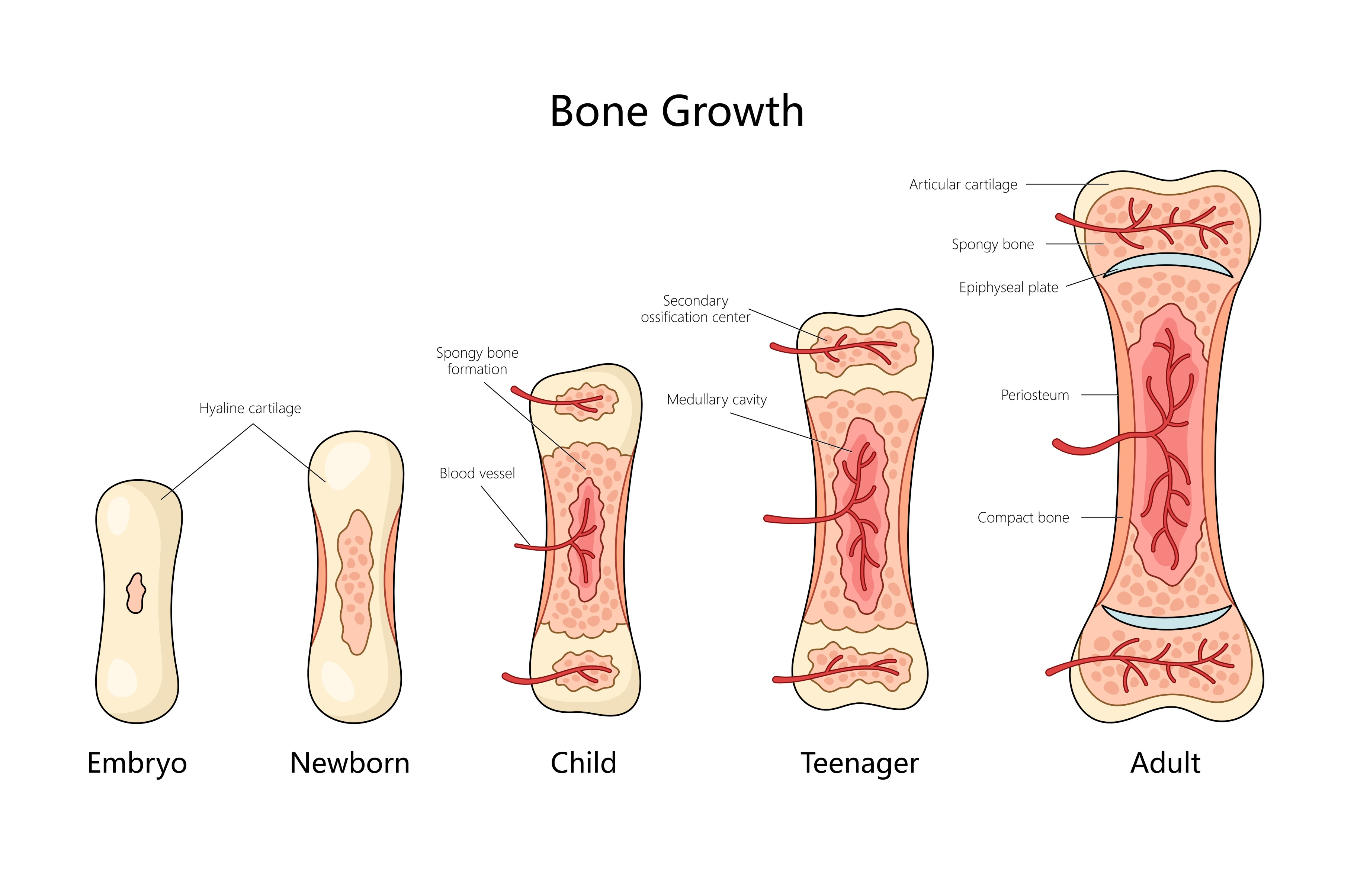 Stages of Bone Growth diagram, an Object Illustration by AlexArt