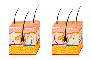 Oily and dry skin anatomy, an Object Illustration by Things for designers
