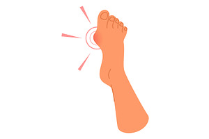 Foot of person with enlarged joint, a Healthcare Illustration by Vectorbuum