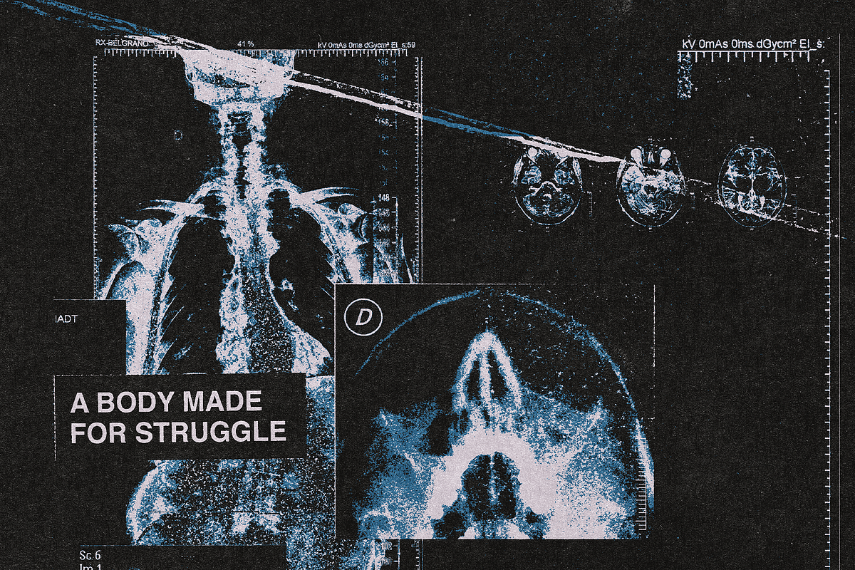 X-Rays Image Pack, a Health & Medical Photo by Design syndrome (Photo 2 of 5)