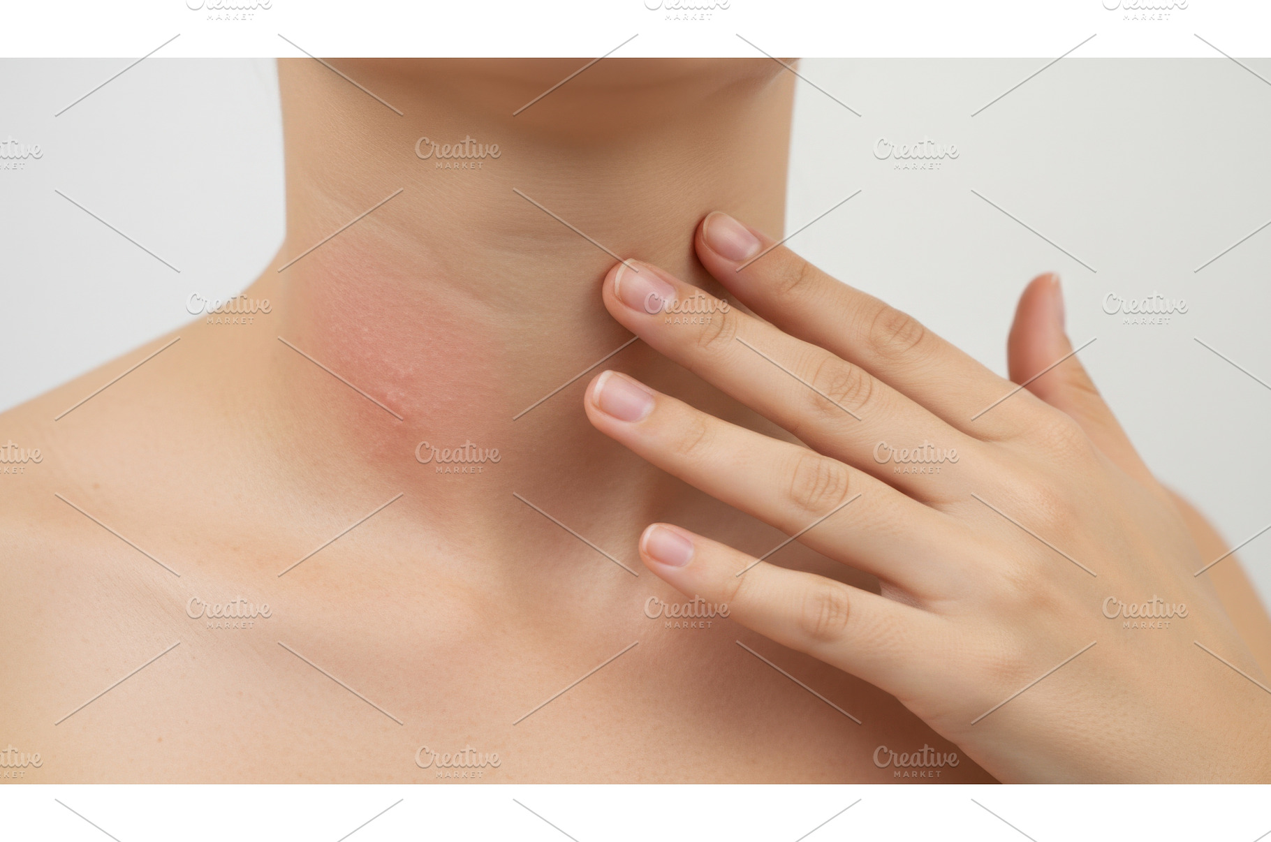 Woman touching inflamed red area on, a Health & Medical Photo by Igor Tichonow