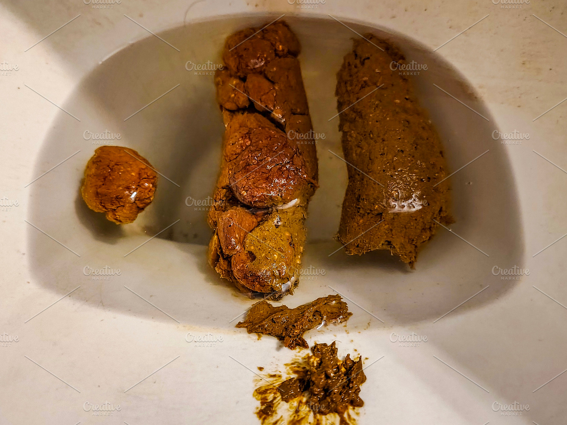 Human feces inside a toilet, a Health & Medical Photo by DanFLCreativo