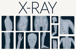 X-rays Skeleton Shots Icons