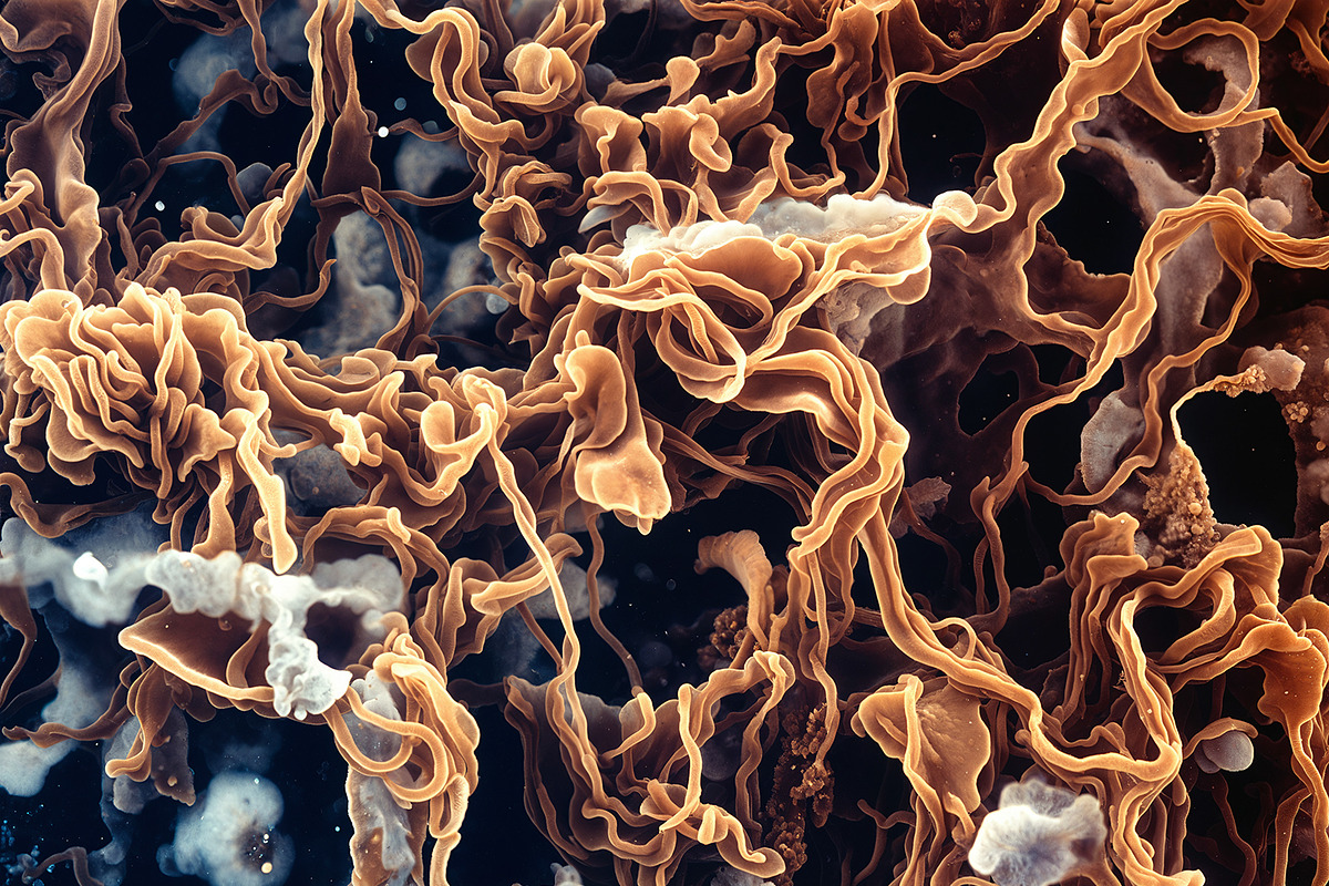 72 Microscopic Fungi Backgrounds, a Background Graphic by h.utomo (Photo 15 of 72)