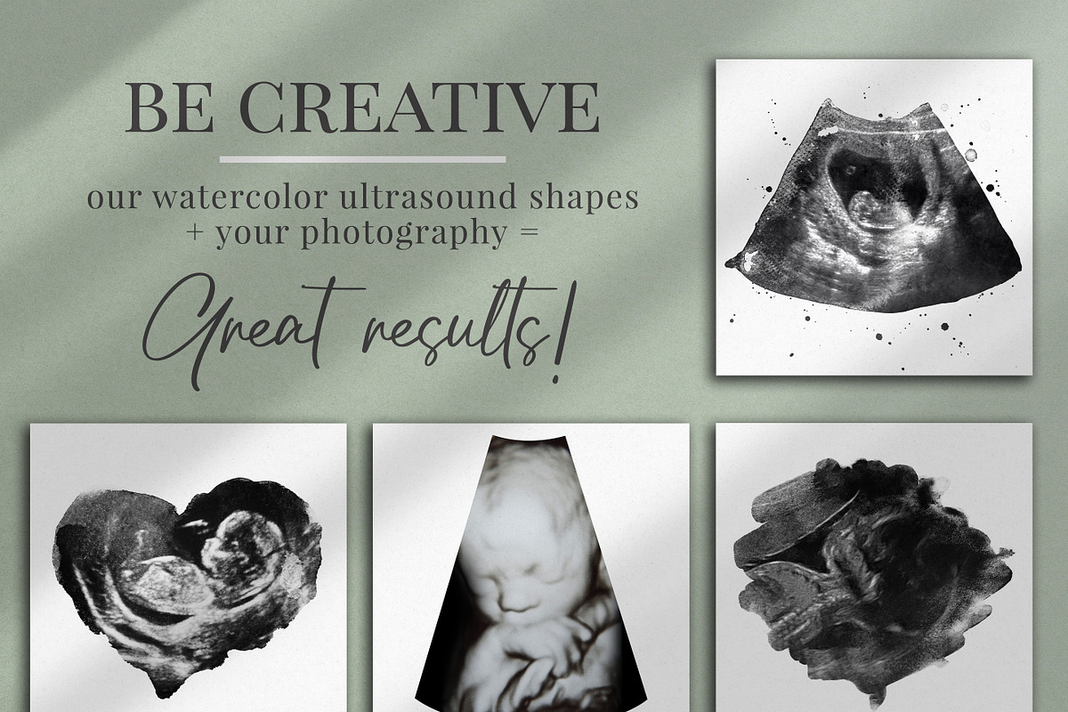 Watercolor ultrasound photomasks, a Layer Style Add-On by BrownLeopard (Photo 5 of 11)