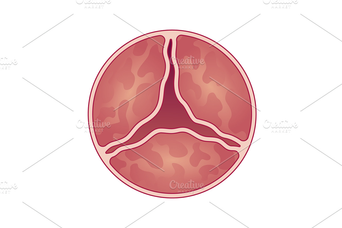 Medical illustration shows, an Object Illustration by Things for designers