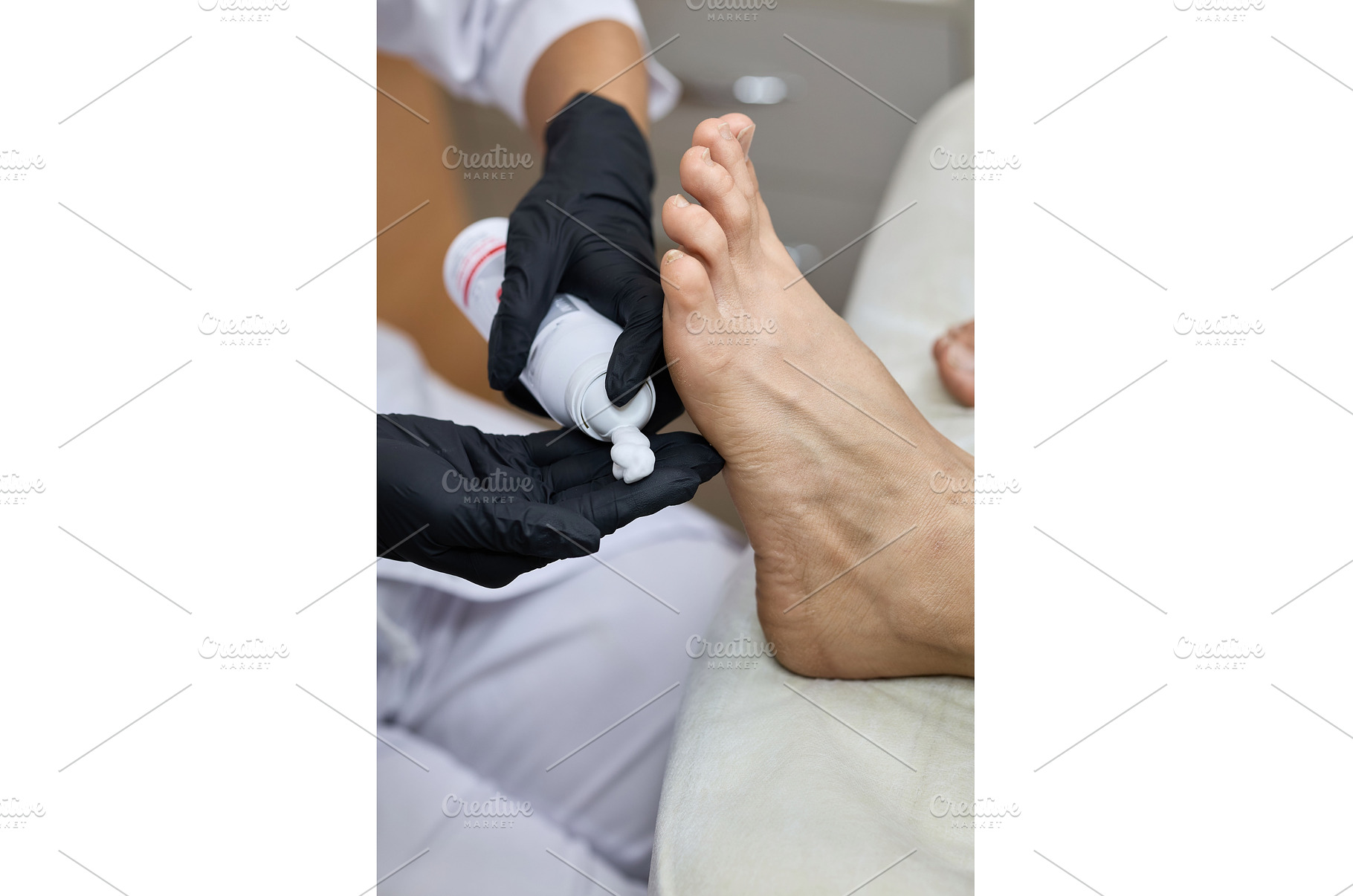 Foot care treatment with, a Health & Medical Photo by wip3out
