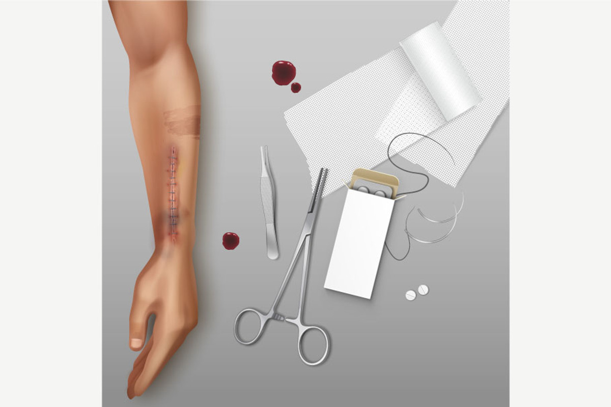 Scars Set, a Healthcare Illustration by Zonda (Photo 3 of 13)