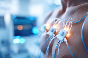 Close-up of medical electrodes on a patient's chest, a Health & Medical Photo by AlyaAnd